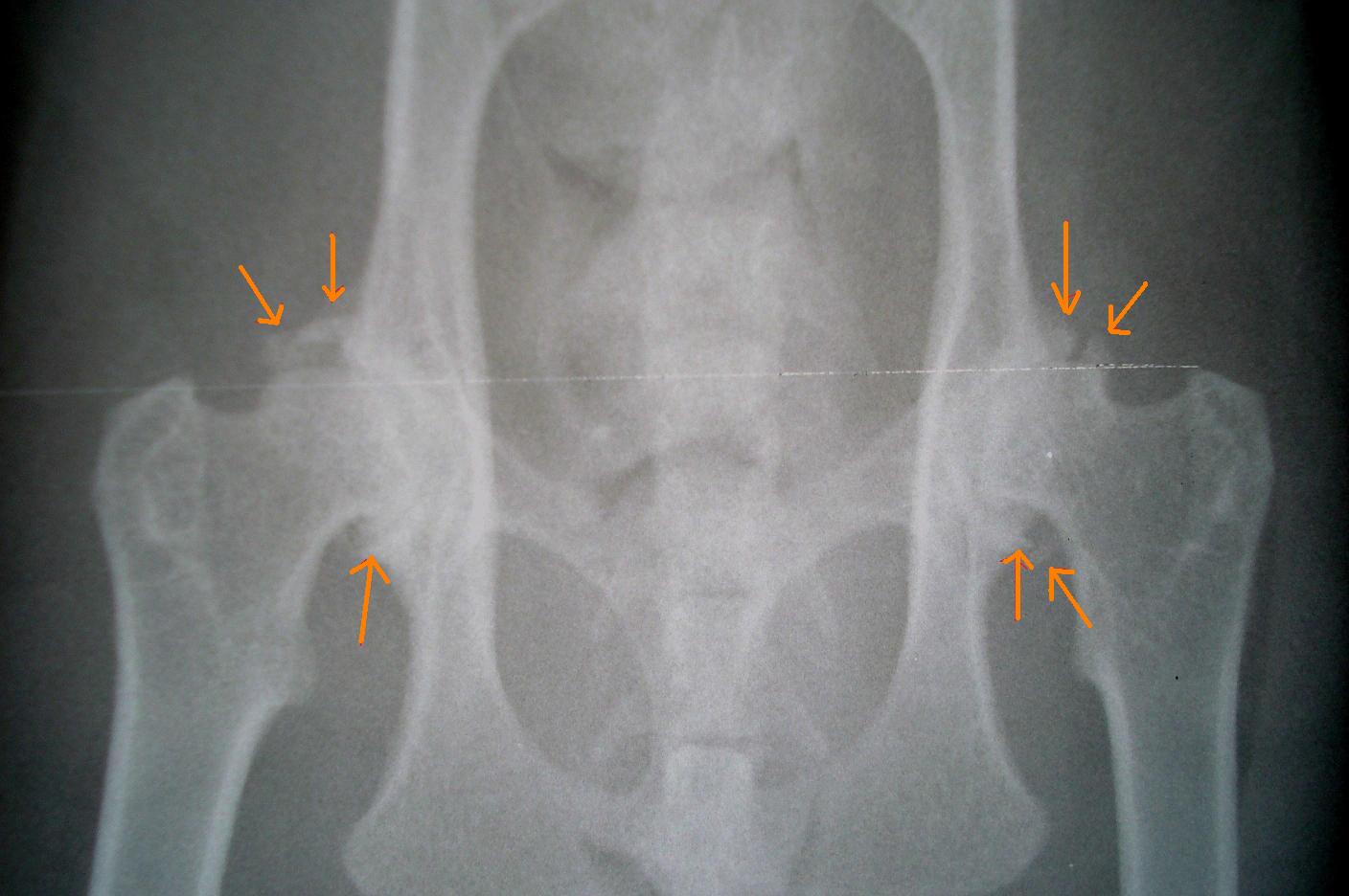 Goodrx Fluticasone Nasal Spray Buy Fluticasone Propionate Nasal Spray