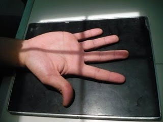 ---RAYOS X 2010--- =): MANO PROYECCION P.A- articulaciones