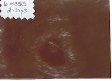 Our first ultrasound