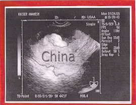 my ultrasound!
