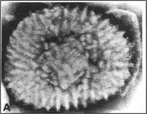 smallpox for nm history Since smallpox was declared officially eradicated, the number of official samples of the virus still maintained worldwide dwindled now only two officially known. smallpox for nm history Since smallpox was declared officially eradicated, the number of official samples of the virus still maintained worldwide dwindled now only two officially known.