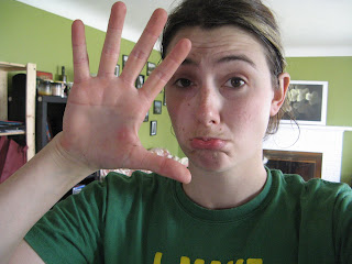 Sad about my blister