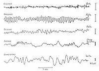 EEG waves occur due to