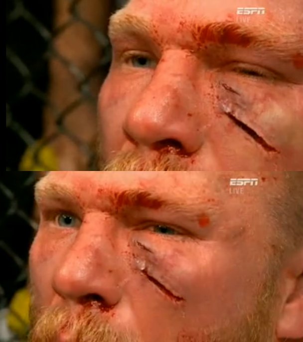 Brock+Lesnar's+Cut.jpg