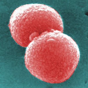 [pneumococcus.jpg]