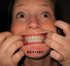 Blanqueador de dientes