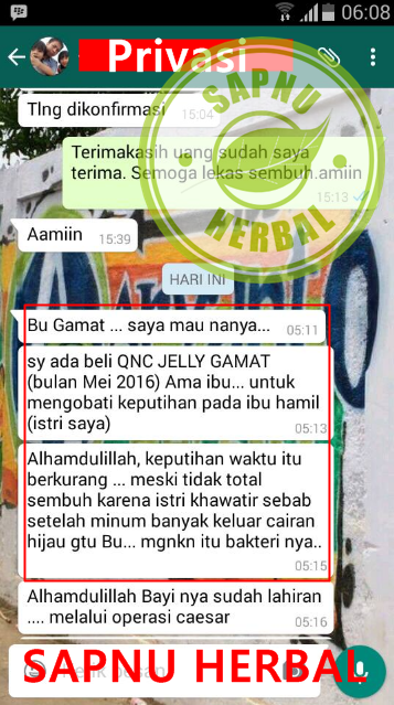 Cara Mengatasi Keputihan Cara Mengatasi Keputihan