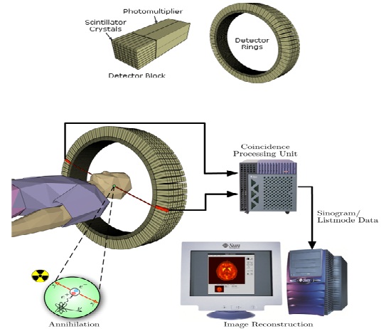 silence tonight: “CT Scanner, PET, MIR, SPECT”