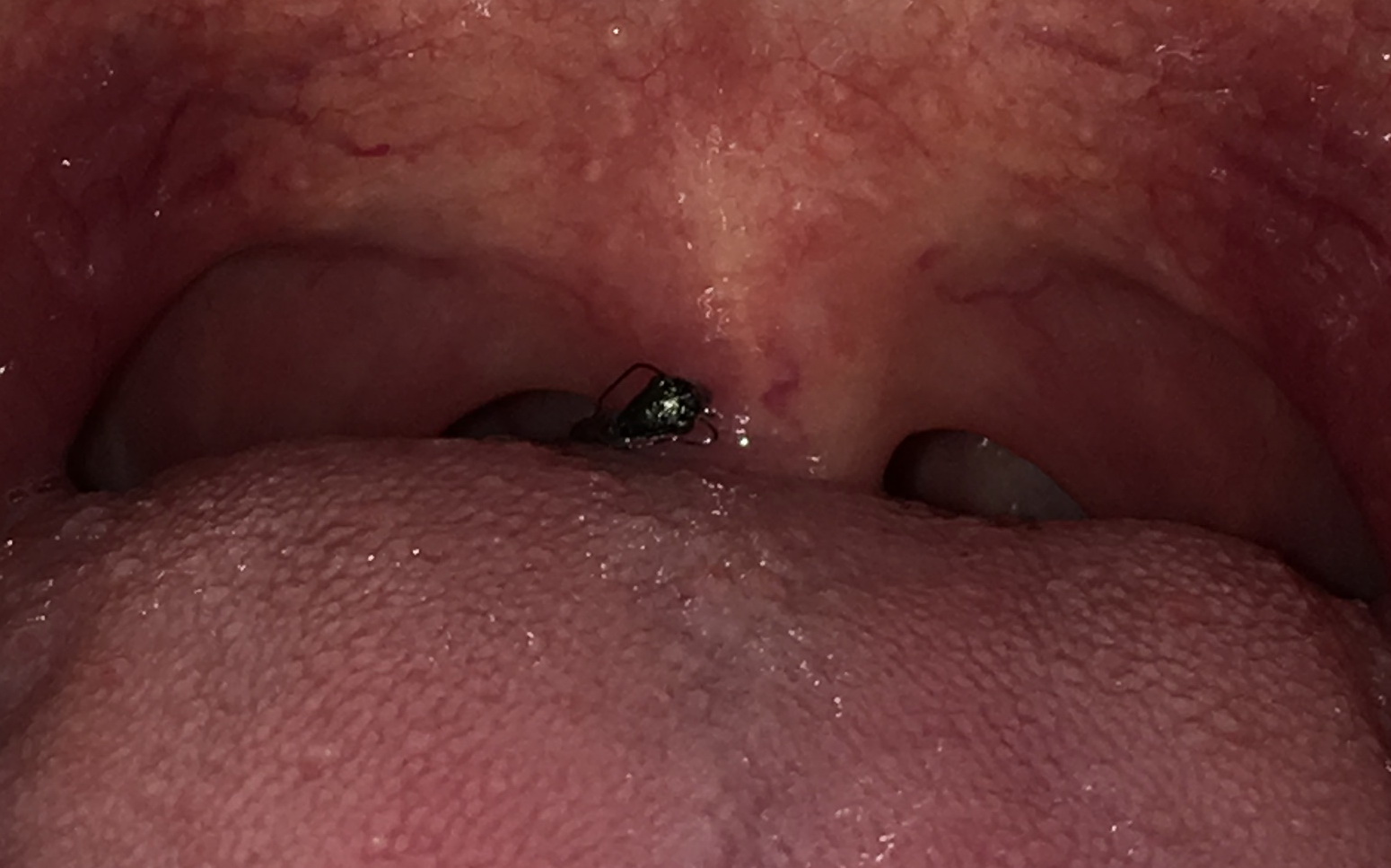 Sylvia's Blog I had an ant stuck in my throat