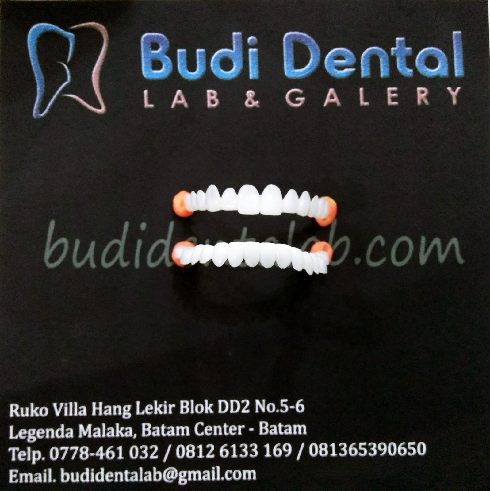 Removable Veneer / Snap On Teeth Budi Dental