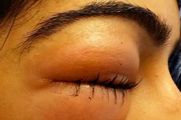 Matamu Sembab Karena Terlalu Banyak Menangis? Jangan Khawatir Gunakan Tips Berikut Ini, Dijamin mengempis Hanya Semalam Saja Matamu Sembab Karena Terlalu Banyak Menangis? Jangan Khawatir Gunakan Tips Berikut Ini, Dijamin mengempis Hanya Semalam Saja
