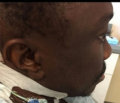 juliu agwu brain surgery