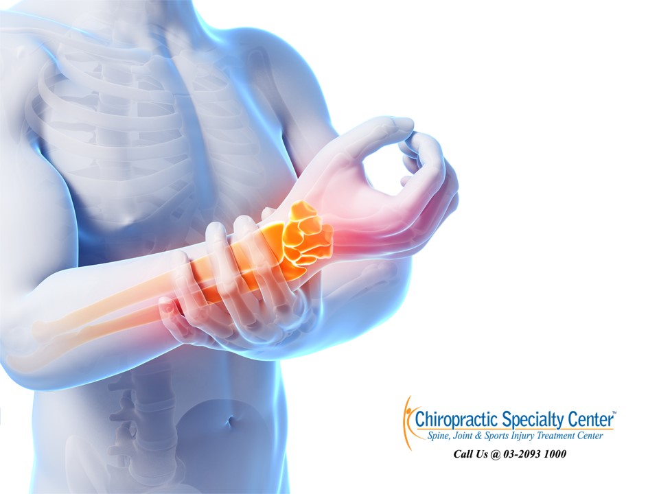 Differential Diagnosis and Treatment of Carpal Tunnel Syndrome