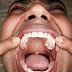 Vijay Kumar V A - The man with the most teeth