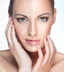 wrinkle filler skin face