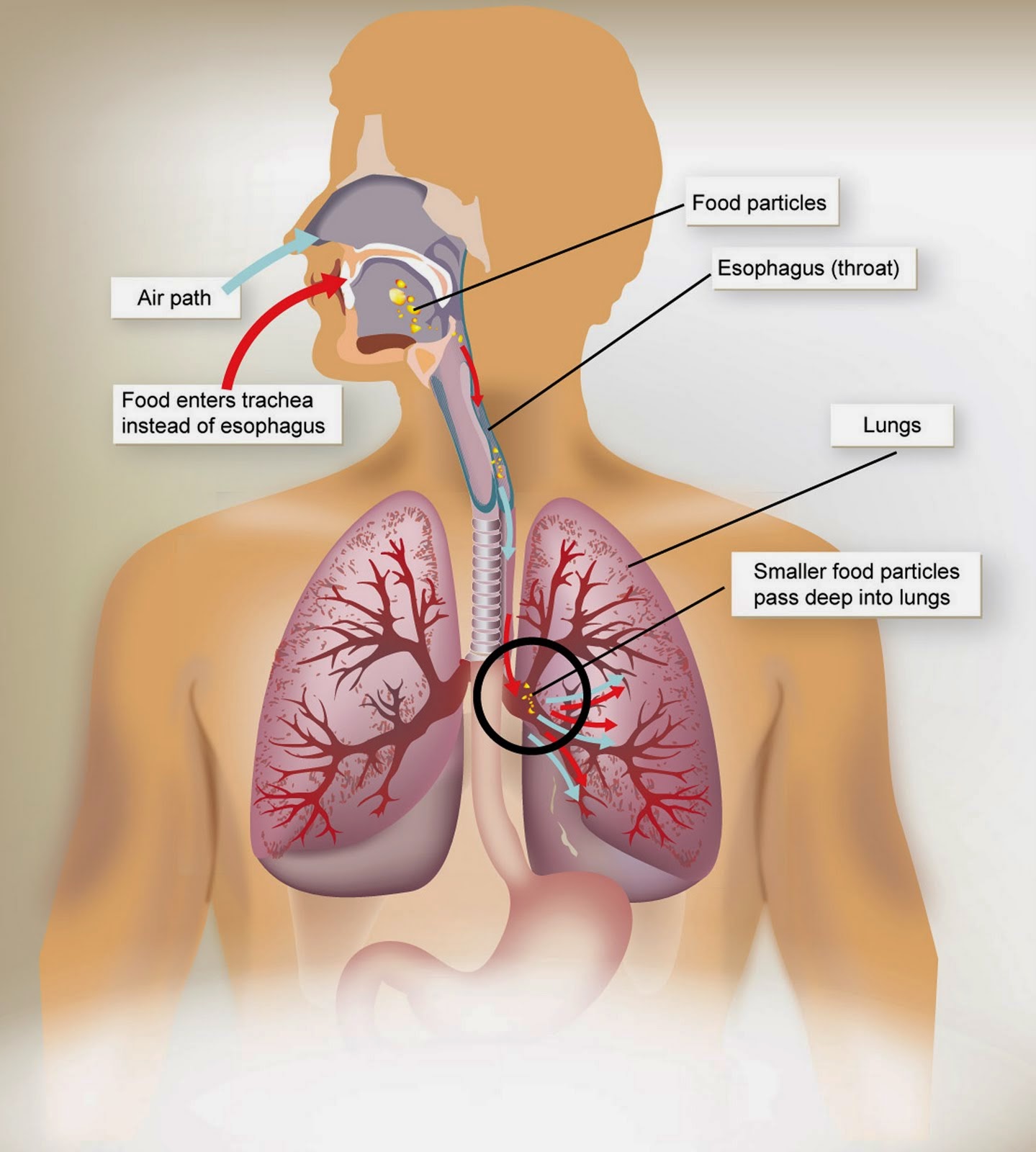 Hasil gambar untuk cara menghilangkan nikotin pada paru2