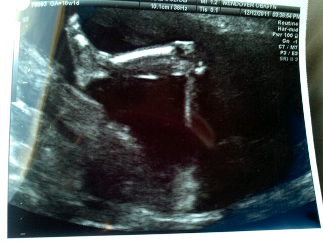 Anatomy Ultrasound Near Me Anatomy Diagram Book