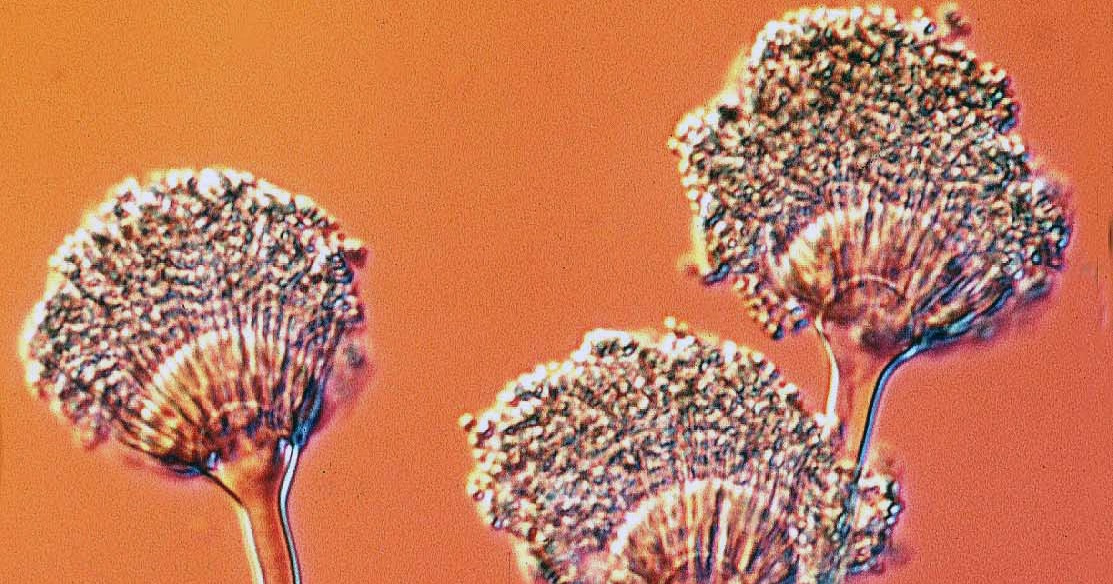  Gambar  Kunci Jawaban Jamur  Aspergillus  Wentii Berperan 