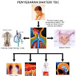 Cara Mengobati Penyakit TBC Yang Alami