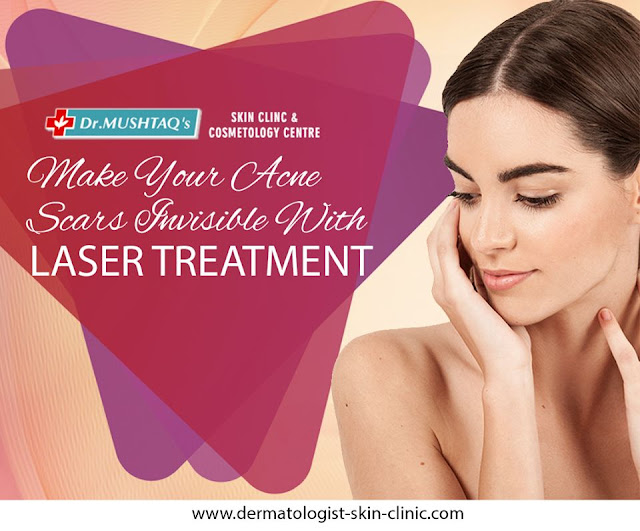 Skin Care Treatments In Kochi