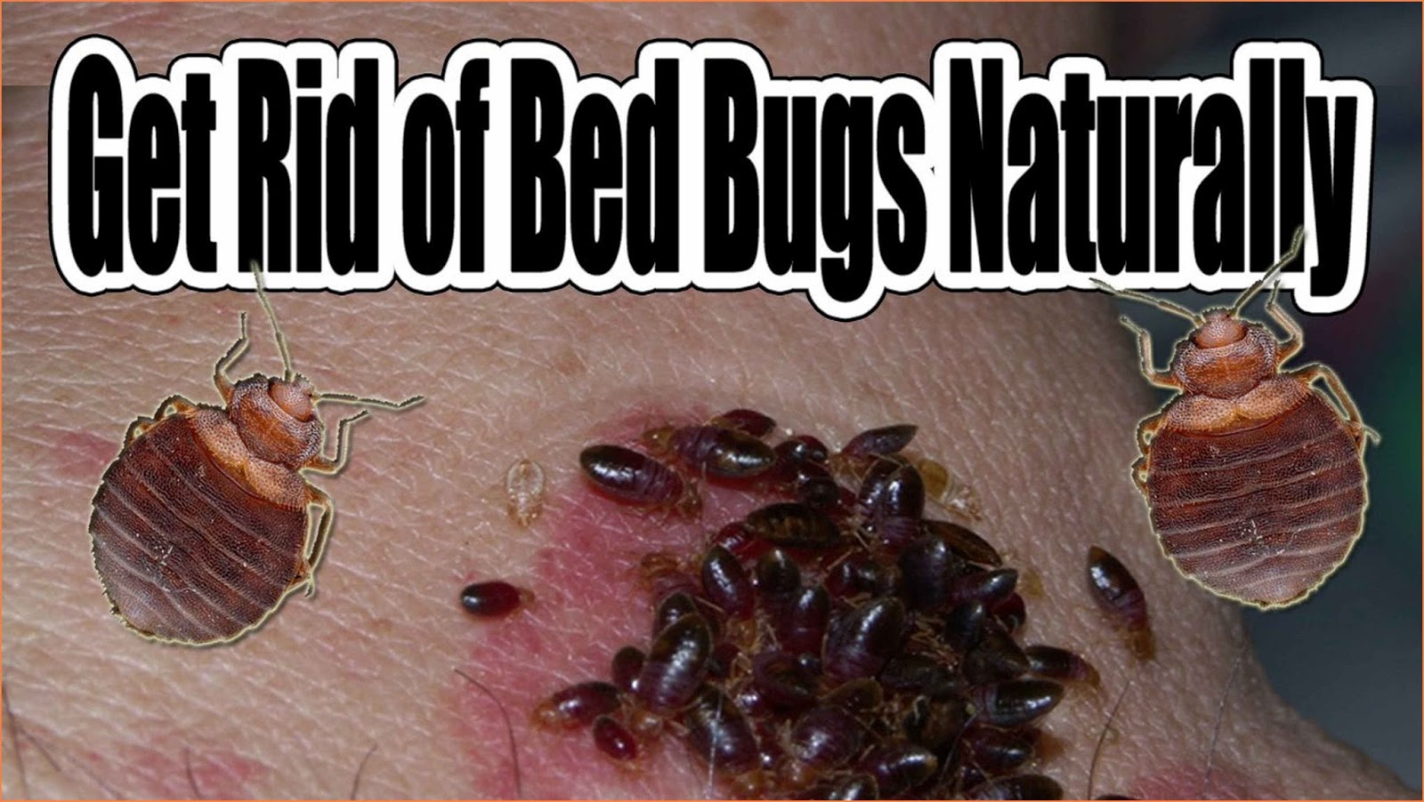 How To Get Rid Of Bedbugs Naturally Caraway Seeds Health Benefits