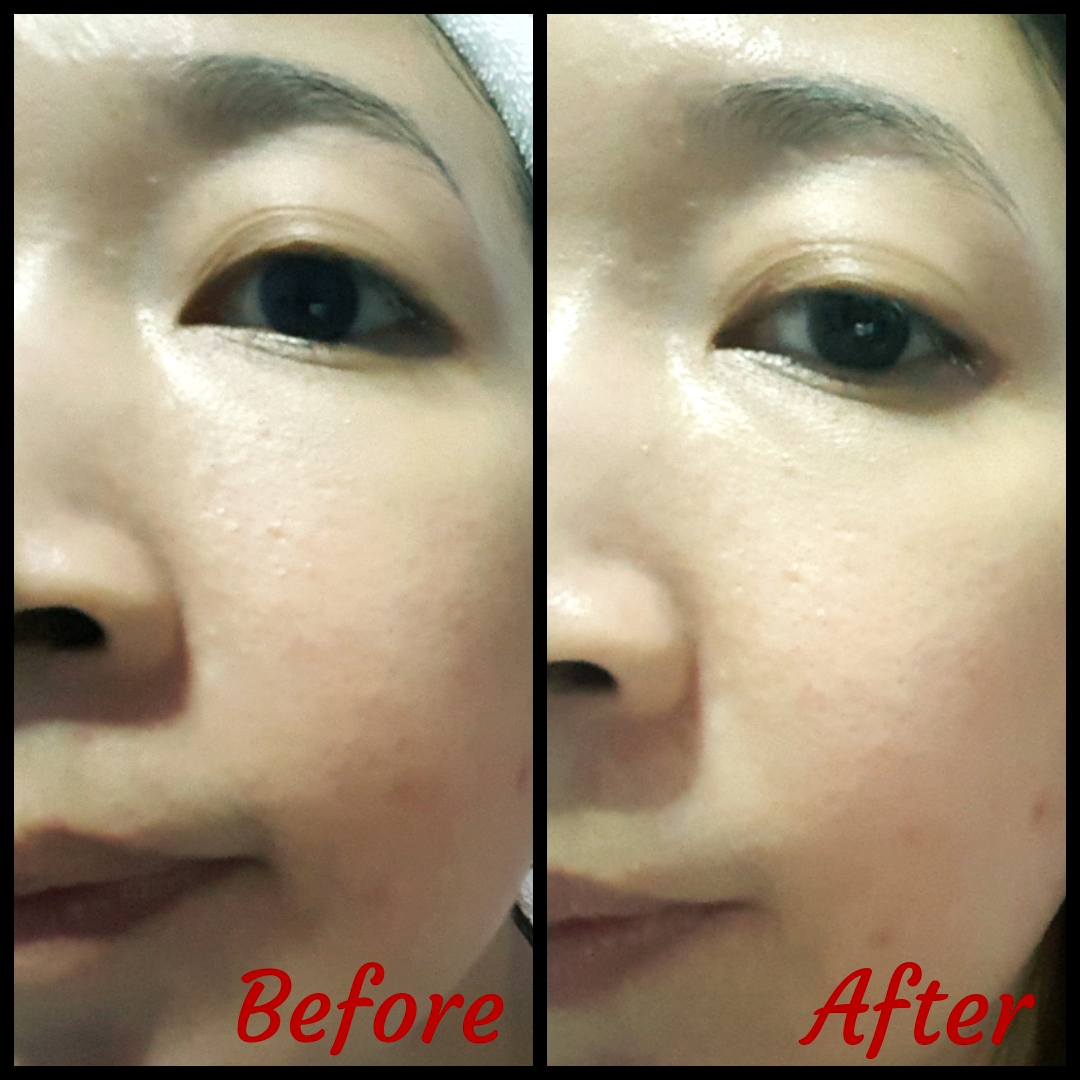 GARNIER PURE ACTIVE MATCHA DEEP CLEAN BLACKHEAD & PORE PURIFYING CLAY