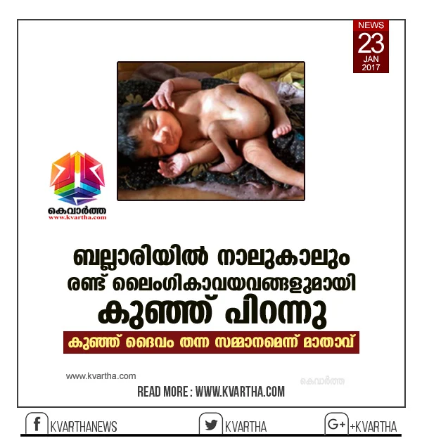 Woman gives birth to baby with 4 legs, 2 male organs, Hospital, Treatment, Mother, Doctor, Case, National.