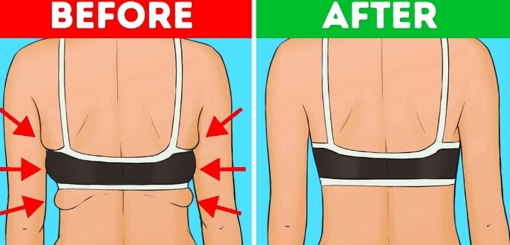 5 Exercises That Get Rid Of Back Fat And Bra Overhang Natural Health Tip