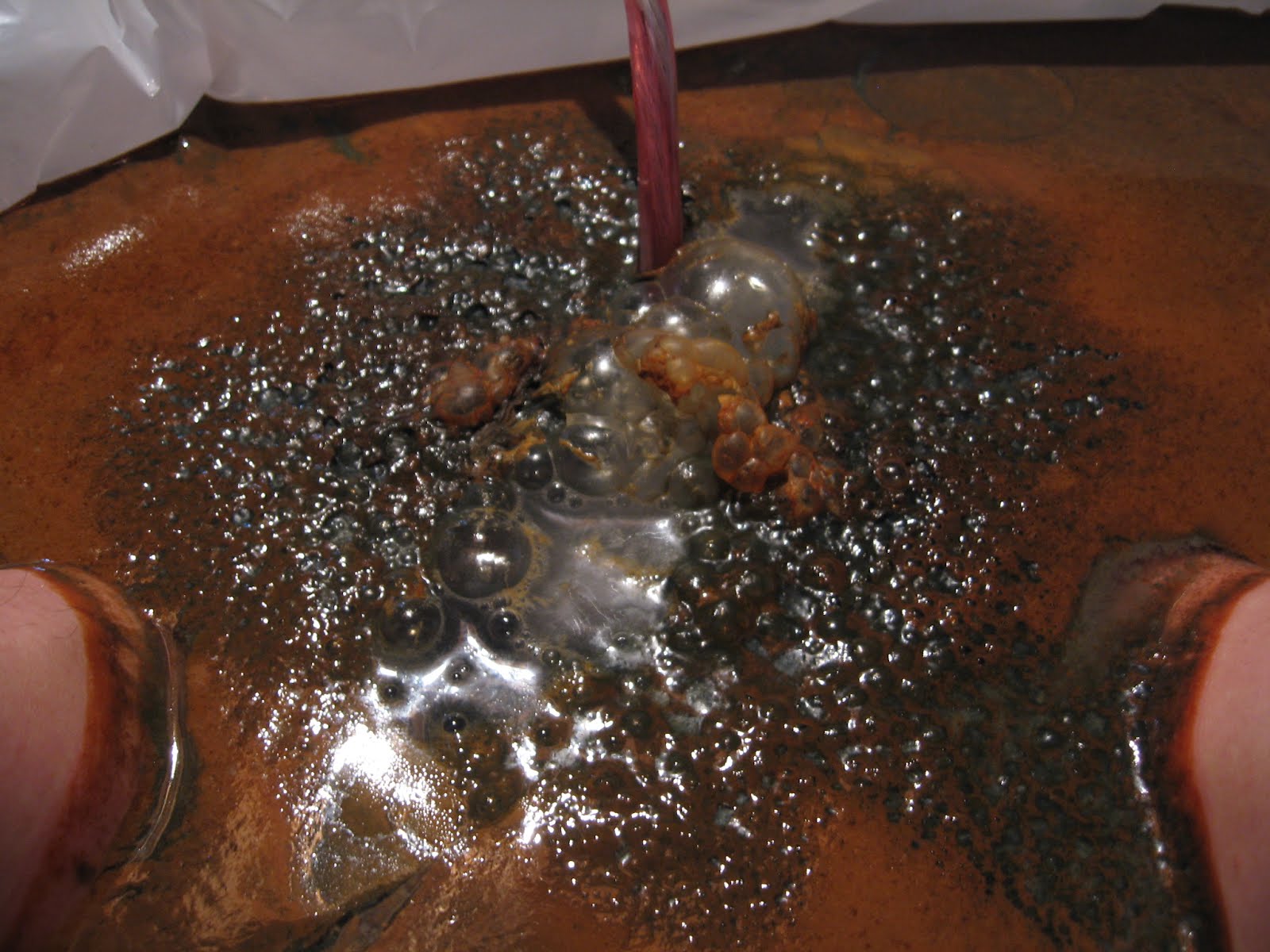 Systemic Candida Ionic Detox Foot Bath