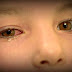 7 Tanda Gangguan Mata pada Anak-anak