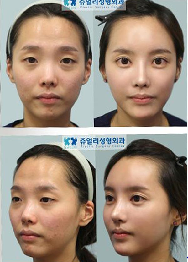 Life's a Picture: Korean Female Faces set on default
