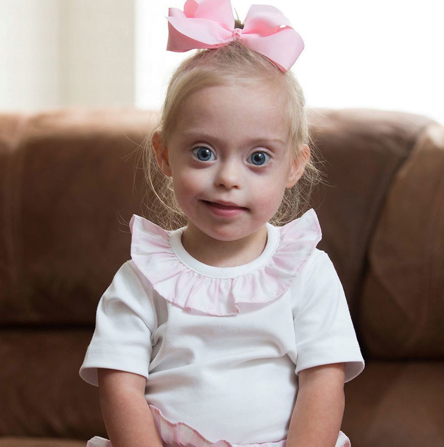 fantastic post Down`s syndrome child