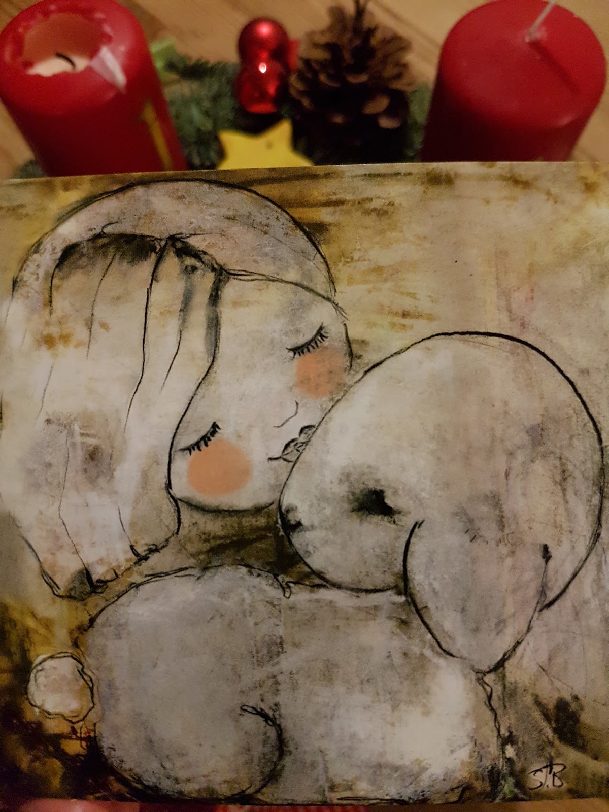 XMAL ANDERS UllrichTurnerSyndrom! Ja,und?! By var url