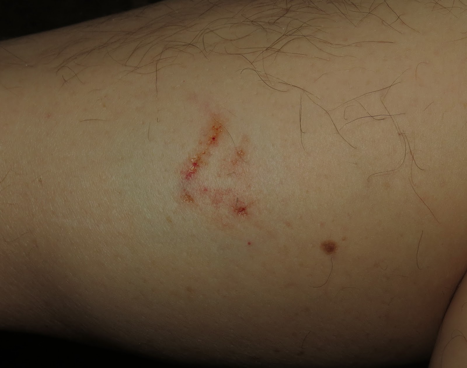 Will A Dog Bite Again