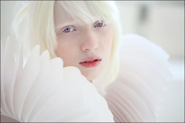 Conheça Nastya, menina albina mais linda do mundo
