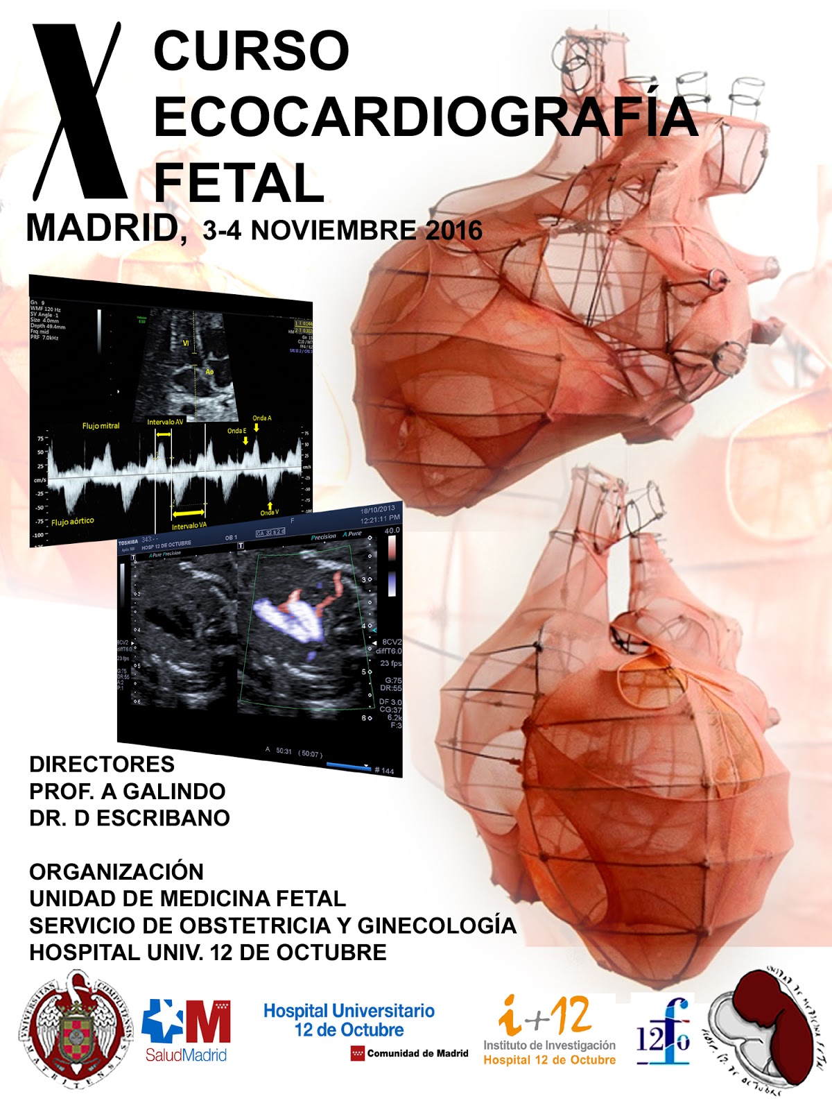 Todo Ecografía Médica XI Curso de Ecocardiografía Fetal