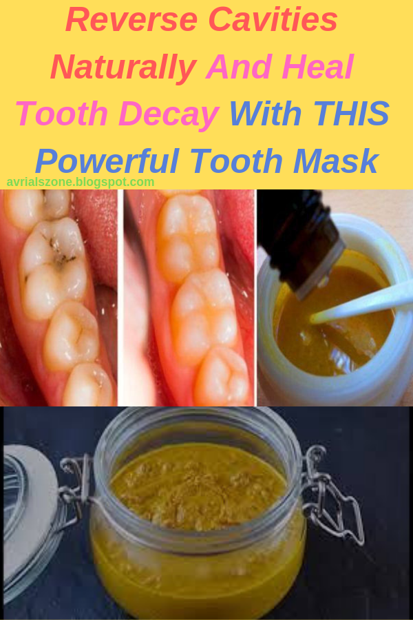 Healthy Beauty and Diet Reverse Cavities Naturally And Heal Tooth Decay With THIS Powerful