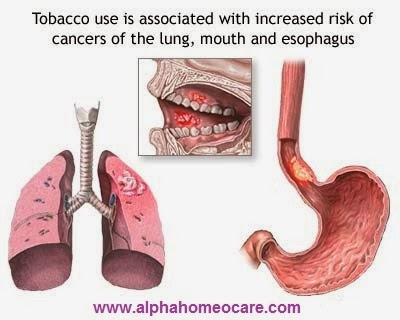 Tobacco and Cancer
