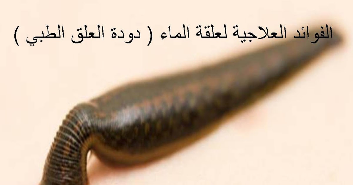 دودة العلق الطبي