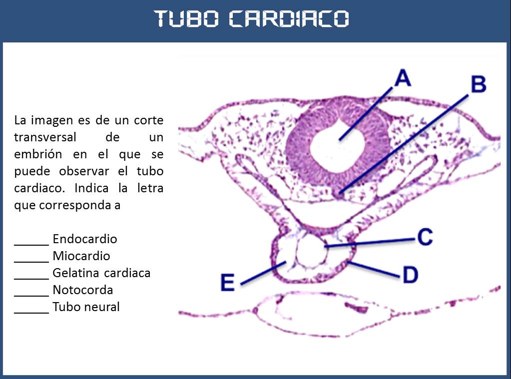 SOS EMBRIOLOGIA HUMANA Tubo cardiaco