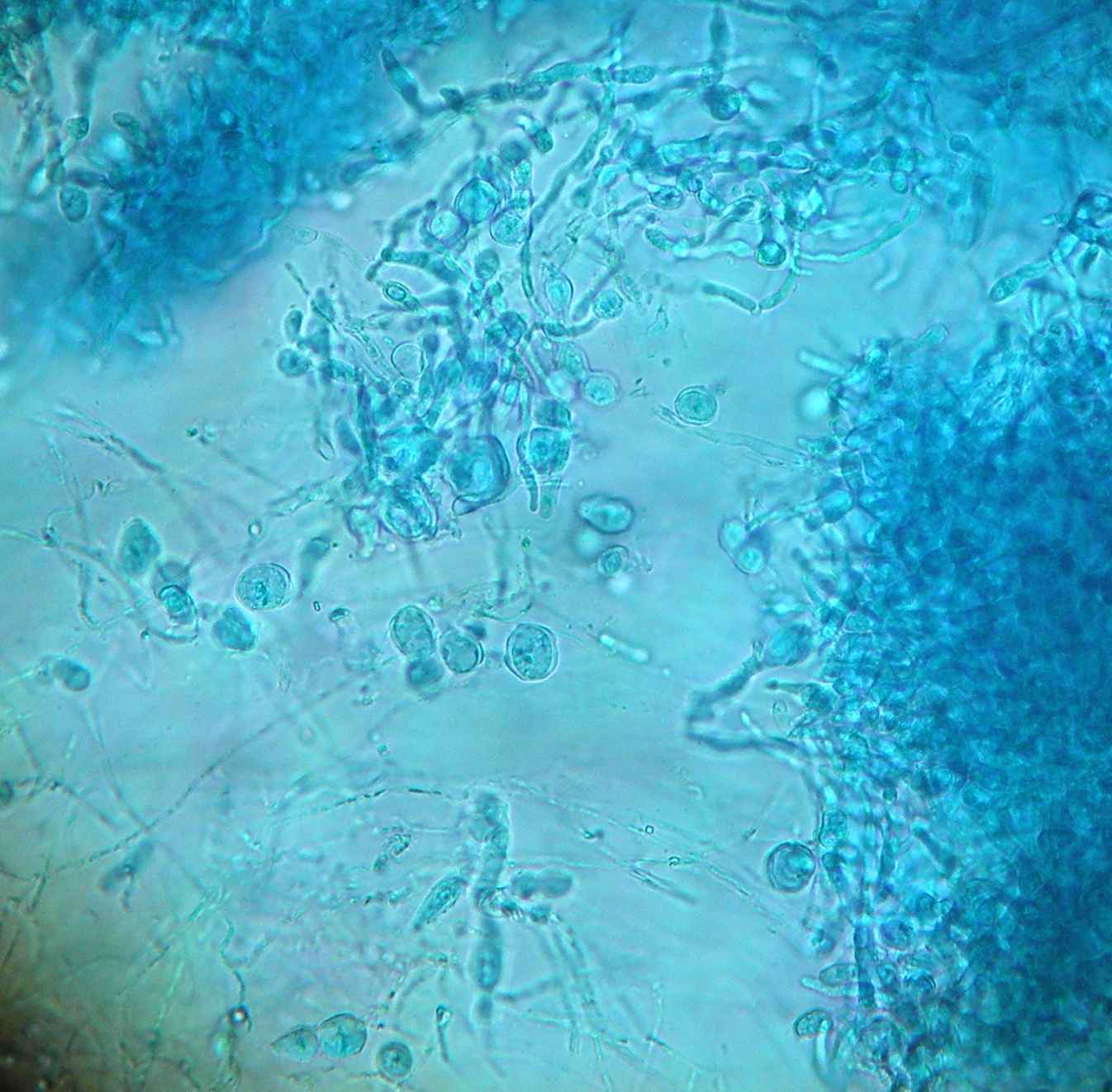 Epidermophyton floccosum