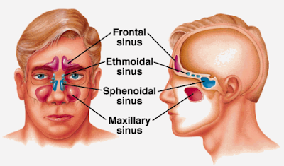 Kill Sinus Infection in 20 Seconds With This Simple Method and This Common Household Ingredient!