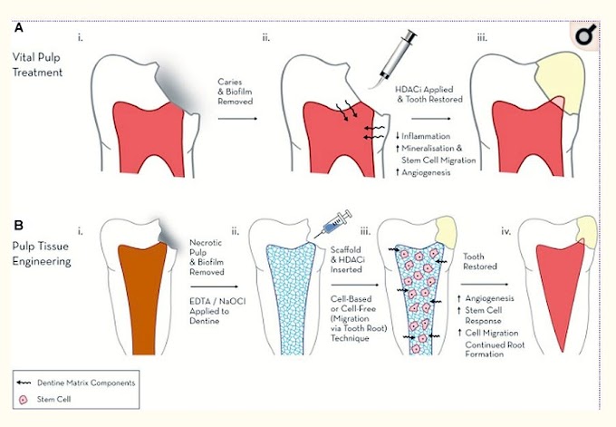 Epigenetic Approaches to the Treatment of Dental Pulp Inflammation and Repair: Opportunities and Obstacles