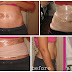 She Slept With Plastic Wrap And Bandages On Her Stomach – What Happened In The Morning Is A Miracle