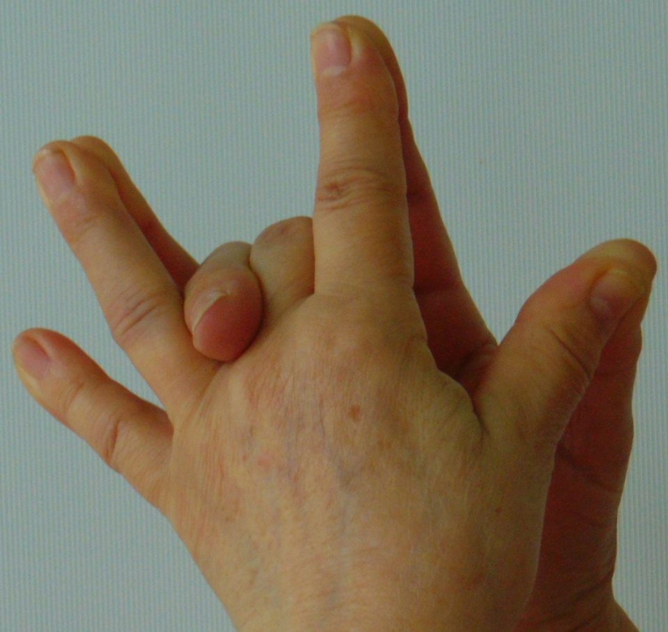 a középső ujj fájó ízülete