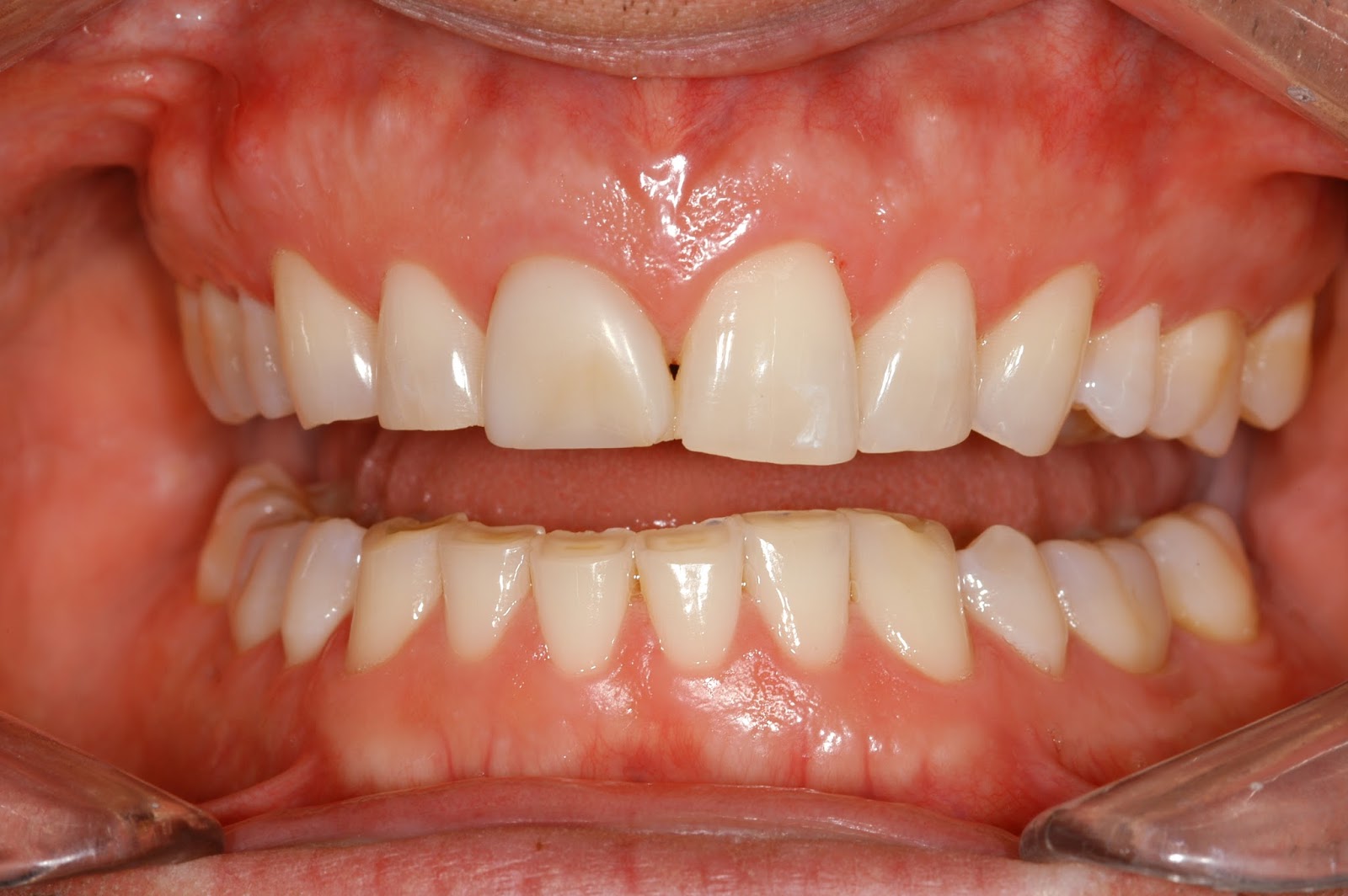 Cornerstone Dental Care