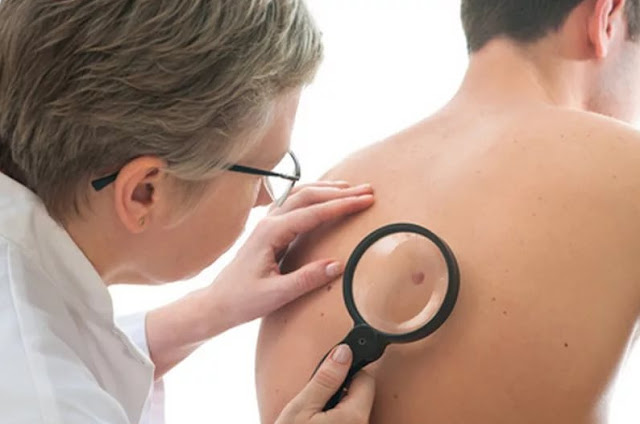 Here's 6 the Symptoms of Cancer In General that Should be In the beware Here's 6 the Symptoms of Cancer In General that Should be In the beware