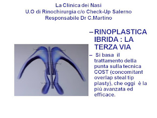 Rinoplastica Ibrida Potenza Un Innovatica Ed Originale Tecnica Per La Rinoplastica I Foto Pre E Post La Clinica Dei Nasi Dr Martino Salerno