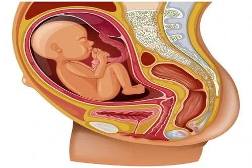 حركة الجنين المقعدي قبل الولادة أسبابه وخطورته
