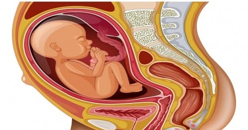 حركة الجنين المقعدي قبل الولادة أسبابه وخطورته